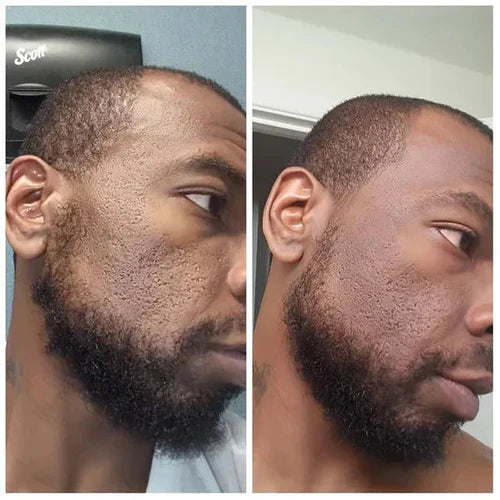 Sérum Éclat à l’Essence de Riz – Hydratation Intense, Réparation & Teint Lumineux